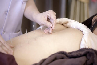  What is Acupuncture?