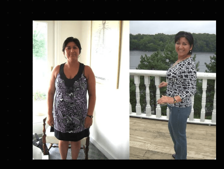 Before and after weight loss transformation - woman lost weight naturally with doctor-supervised drops program